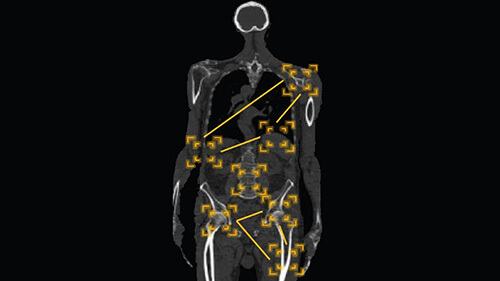 Darstellung Scan im Siemens CT der Radiologie Freiburg
